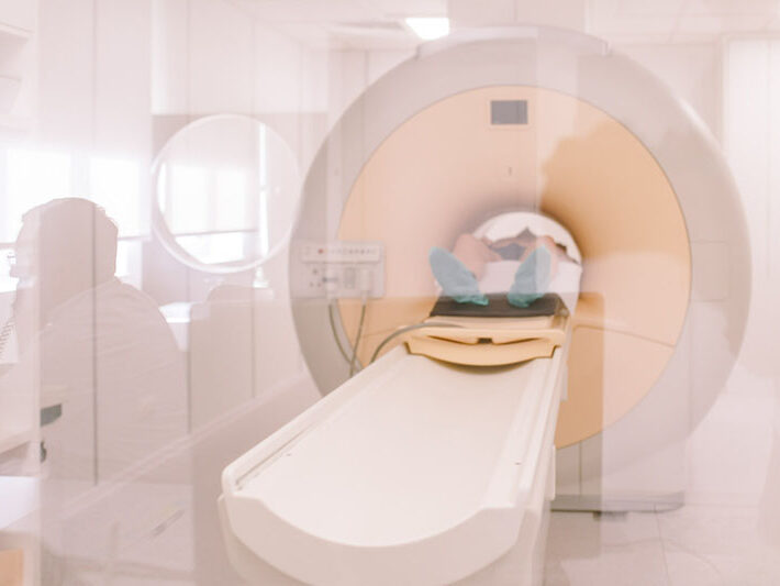 magnetska-rezonanca-cijena Magnetska rezonanca 3 Tesla